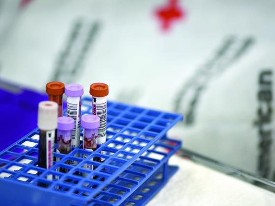 The American Red Cross is now testing all blood, platelet and plasma donations for COVID-19 antibodies.